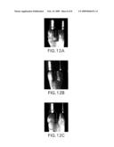 Dental Light Guide diagram and image