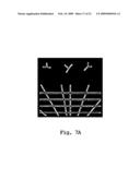 Method for enhancing blood vessels in angiography images diagram and image