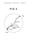 RADIATION IMAGING APPARATUS AND METHOD OF CONTROLLING THE SAME diagram and image