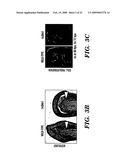 METHODS FOR INCREASING CELL OR TISSUE REGENERATION IN A VERTEBRATE SUBJECT diagram and image
