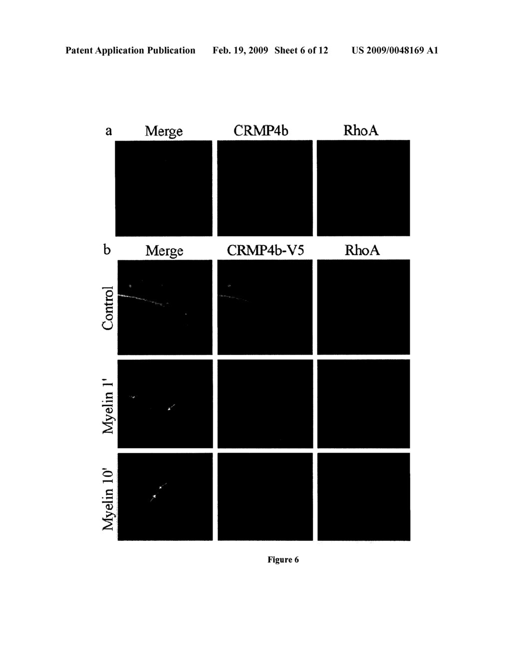 Identification of Crmp4 as a Convergent Regulator of Axon Outgrowth Inhibition - diagram, schematic, and image 07