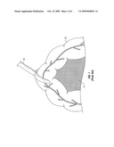 METHOD AND APPARATUS FOR LAPAROSCOPIC RETRACTION diagram and image