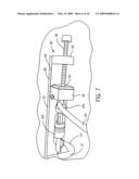 MEDICAL PROBE INTRODUCER diagram and image