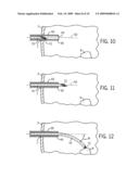 MEDICAL PROBE INTRODUCER diagram and image