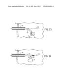 MEDICAL PROBE INTRODUCER diagram and image