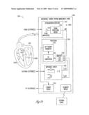 CLOSED LOOP IMPEDANCE-BASED CARDIAC RESYNCHRONIZATION THERAPY SYSTEMS, DEVICES, AND METHODS diagram and image