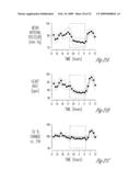 BAROREFLEX STIMULATION TO TREAT ACUTE MYOCARDIAL INFARCTION diagram and image