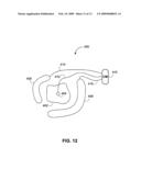 Medical electrode systems and methods diagram and image