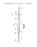 Two-step/dual-diameter balloon angioplasty catheter for bifurcation and side-branch vascular anatomy diagram and image