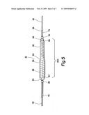 Two-step/dual-diameter balloon angioplasty catheter for bifurcation and side-branch vascular anatomy diagram and image