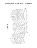  Stent Configurations diagram and image