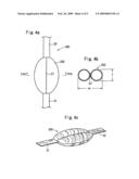 Air Belt and Air Belt Apparatus diagram and image