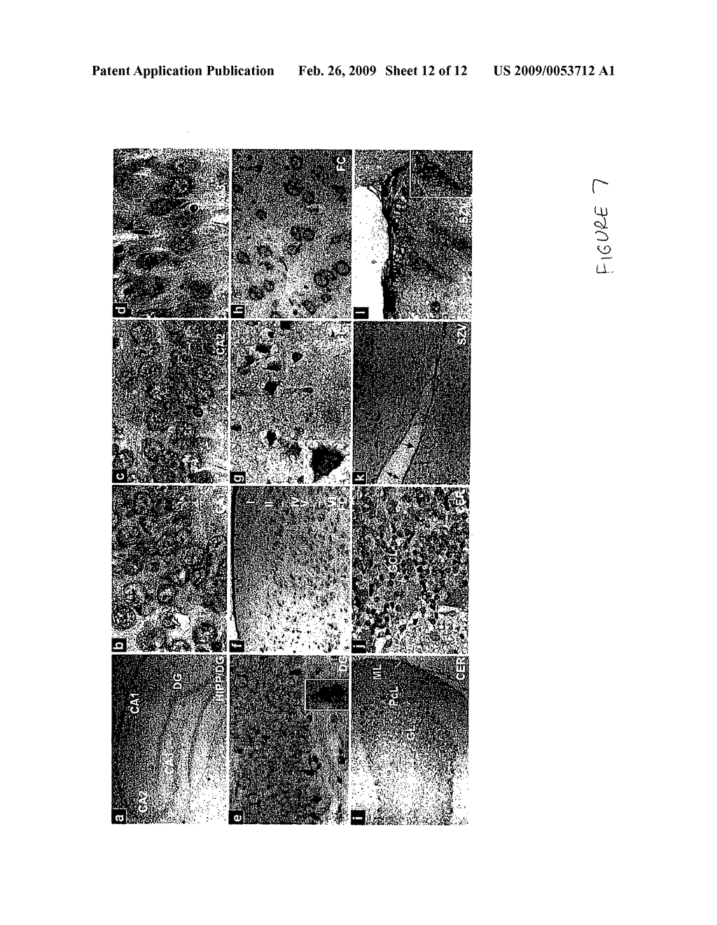 Methods of using LEDGF/p75 - diagram, schematic, and image 13