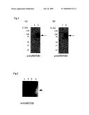 Vector expressing n-deacetylase/n-sulfotransferase 2 diagram and image