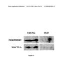 HEMOGLOBIN-BASED METHODS FOR PROPHYLAXIS, DIAGNOSIS AND/OR TREATMENT OF RETINAL DISORDERS diagram and image