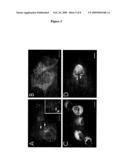 CONNEXIN 40 TISSUE SPECIFIC GENE MUTATIONS diagram and image