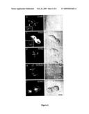 CONNEXIN 40 TISSUE SPECIFIC GENE MUTATIONS diagram and image