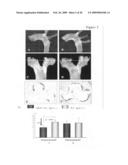 Use of heat-shock protein 27 for cardiovascular disease prevention and treatment diagram and image