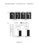 Use of heat-shock protein 27 for cardiovascular disease prevention and treatment diagram and image