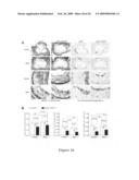 Use of heat-shock protein 27 for cardiovascular disease prevention and treatment diagram and image