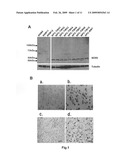 Genetic markers and methods for detecting and treating cancers diagram and image