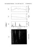 ULTRASONIC DIAGNOSTIC APPARATUS diagram and image