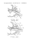 Targeted biopsy delivery system diagram and image