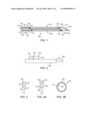 Method and Apparatus for Treating Stenoses at Bifurcated Regions diagram and image