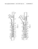 Method and Apparatus for Treating Stenoses at Bifurcated Regions diagram and image