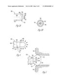 Systems and devices for photoablation diagram and image