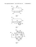 Systems and devices for photoablation diagram and image