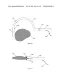 Surgical instruments with sensors for detecting tissue properties, and system using such instruments diagram and image