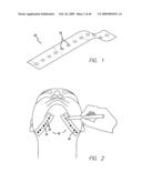 SURGICAL THREADING DEVICE AND METHOD FOR USING SAME diagram and image