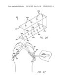 SURGICAL THREADING DEVICE AND METHOD FOR USING SAME diagram and image