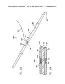 SURGICAL THREADING DEVICE AND METHOD FOR USING SAME diagram and image