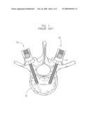 Electrode for Stimulating Bone Growth, Tissue Healing and/or Pain Control, and Method of Use diagram and image