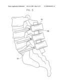 Electrode for Stimulating Bone Growth, Tissue Healing and/or Pain Control, and Method of Use diagram and image