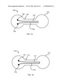 SYSTEM FOR TRANSMITTING ELECTRICAL CURRENT TO A BODILY TISSUE diagram and image