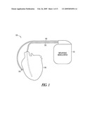 Optical depolarization of cardiac tissue diagram and image