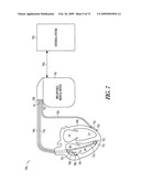 Optical depolarization of cardiac tissue diagram and image