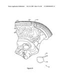 Systems and Methods for Treating Neurological Disorders by Light Stimulation diagram and image