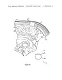 Systems and Methods for Treating Neurological Disorders by Light Stimulation diagram and image