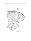 Systems and Methods for Treating Neurological Disorders by Light Stimulation diagram and image