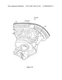 Systems and Methods for Treating Neurological Disorders by Light Stimulation diagram and image