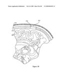 Systems and Methods for Treating Neurological Disorders by Light Stimulation diagram and image