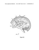 Systems and Methods for Treating Neurological Disorders by Light Stimulation diagram and image