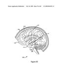 Systems and Methods for Treating Neurological Disorders by Light Stimulation diagram and image