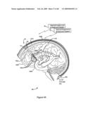 Systems and Methods for Treating Neurological Disorders by Light Stimulation diagram and image