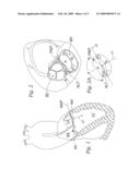 Four-leaflet stented mitral heart valve diagram and image