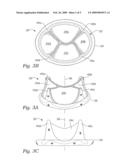 Four-leaflet stented mitral heart valve diagram and image